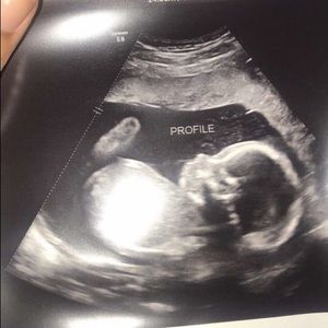 Meet your Posher, Laterica